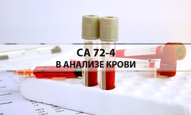 СА 72-4 в анализе крови