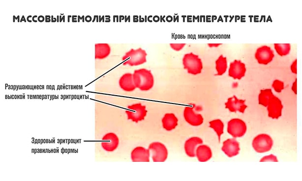 Распад эритроцитов, анемия