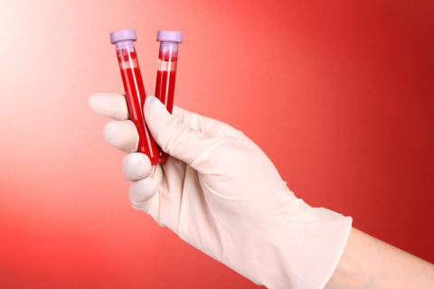 Анализы крови могут определить наличие воспаления в организме