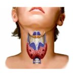 Больная щитовидка – причина появления песка