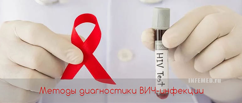 Способы диагностики ВИЧ инфекции