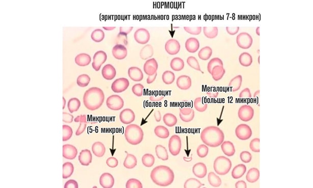 Нормоцит