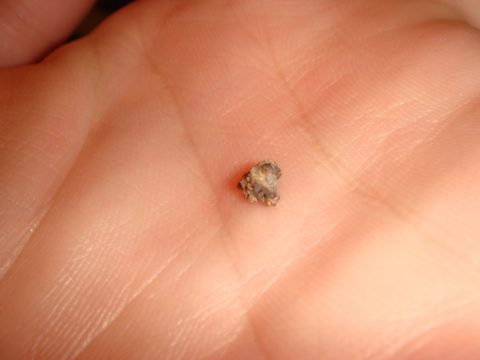 Крошечные кристаллы представляют немалую опасность для здоровья человека
