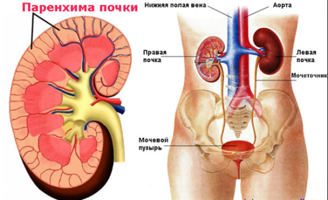 Паренхима почек подвергается структурным изменениям вследствие развития патологических процессов внутри органа.