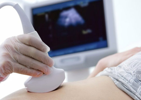 При беременности часто диагностируют расширение лоханок, но это является вариантом нормы
