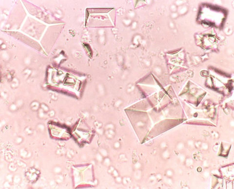 Солевые кристаллы (песок) под микроскопом
